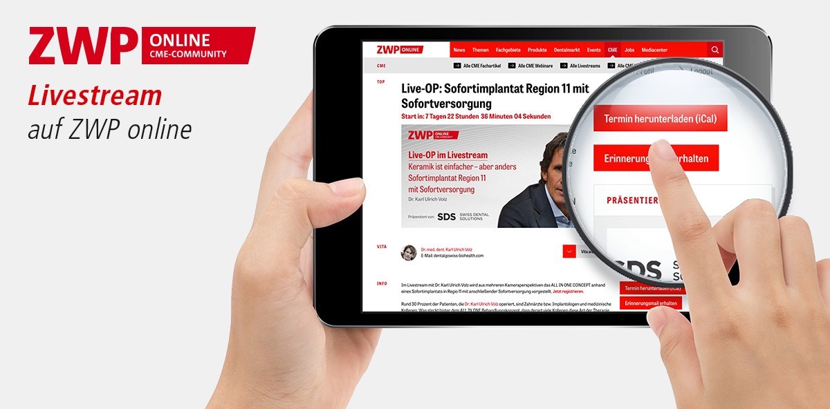 Keine Live-OP mehr verpassen: Erinnerungsfunktion auf ZWP online