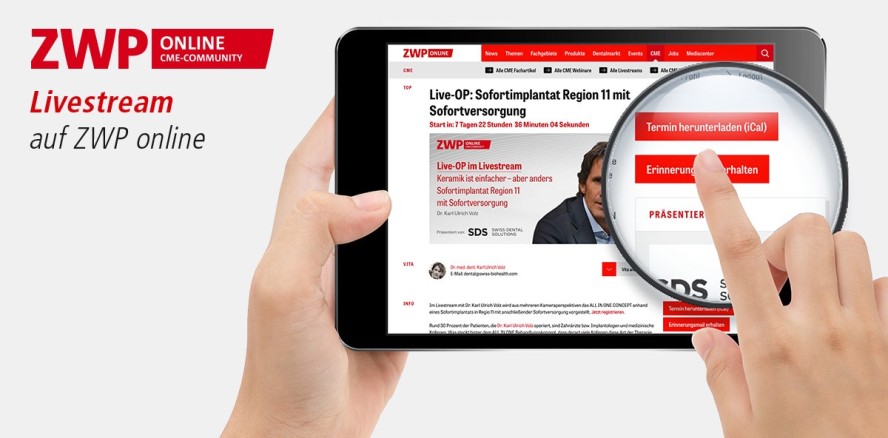 Keine Live-OP mehr verpassen: Erinnerungsfunktion auf ZWP online