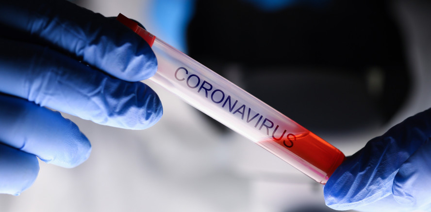 Coronavirus: Erster Fall in der Schweiz – was ist zu beachten?