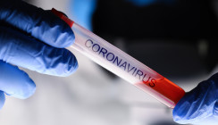 Coronavirus: Erster Fall in der Schweiz – was ist zu beachten?