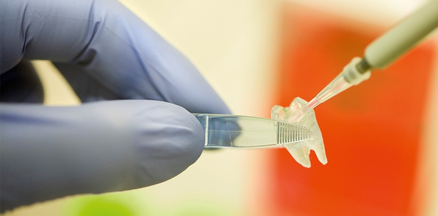 Experimentieren für die Zukunft der Endodontie