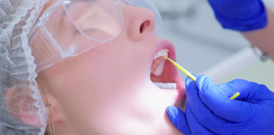 Fluorid-Maßnahmen beugen Wurzelkaries vor – aber welche?