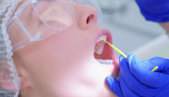 Fluorid-Maßnahmen beugen Wurzelkaries vor – aber welche?