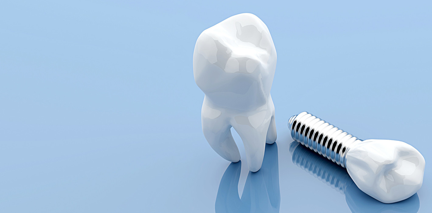 Innovative Forschung: Damit Implantate länger halten