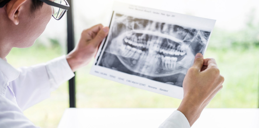 4.000 Euro Schmerzensgeld wegen verlorener Fräse in Kieferhöhle