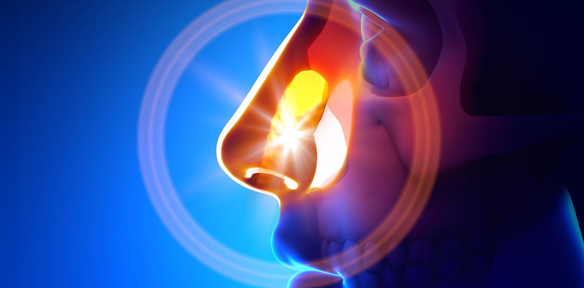 Permanentes Nasenbluten: Rhinitis stellt sich als eingewachsener Zahn heraus