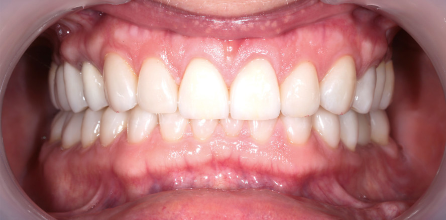 Der Patient als Ganzes – aesthetics meets function