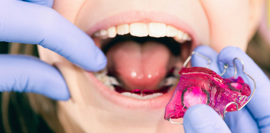 Kündigung der Kieferorthopädie-Kassenverträge in Salzburg