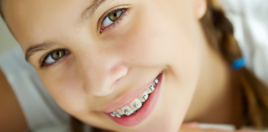 WGKK: Zwei Jahre Gratiszahnspange – ein Erfolg