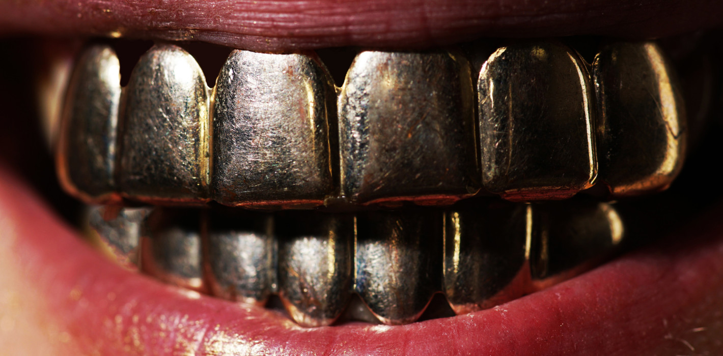 Grillz-Debakel: Erst goldenes, dann zahnloses Lächeln