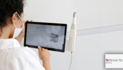 Digitale KFO: Einführung eines Intraoralscanners in der Praxis