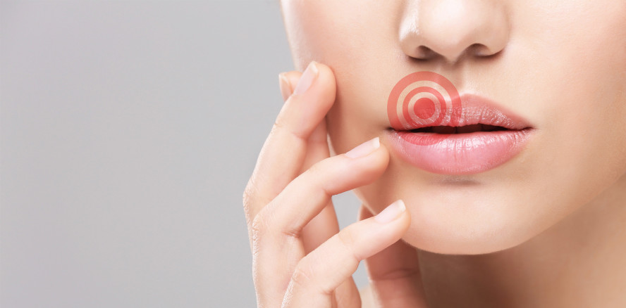 Neuer Therapieansatz gegen Herpes entdeckt