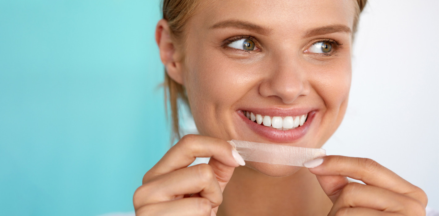 SSO warnt ausdrücklich vor «Do-it-yourself-Bleaching»