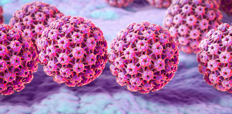 HPV auf dem Vormarsch: Mund- und Rachenkrebs durch Oralsex