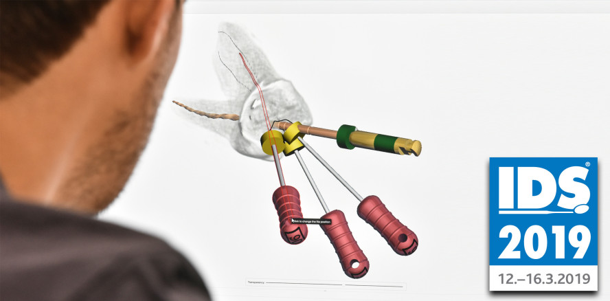 Endo mit Tempo in die digitale Welt – IDS-Innovationen 2019