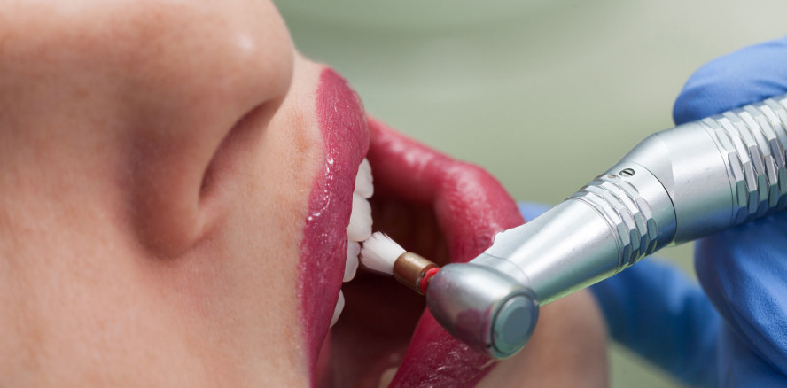 IGeL-Monitor bewertet Nutzen einer PZR als „unklar“