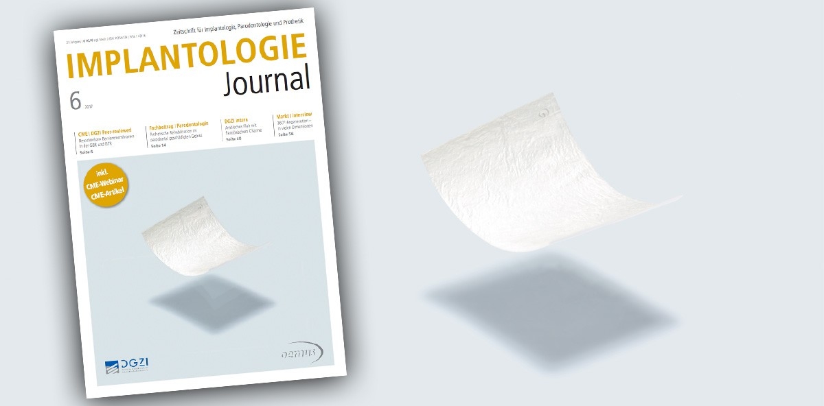 Juni-Ausgabe des Implantologie Journals vorab als ePaper lesen