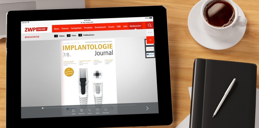 Aktuelles Implantologie Journal mit Fokus auf Keramikimplantaten