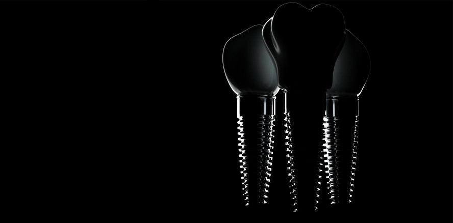 „Implant Files“ deckt auch Fälle mit Dentalprodukten auf