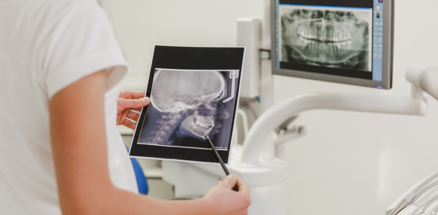 Österreicherin erhält im Jochbein fixierte Implantate