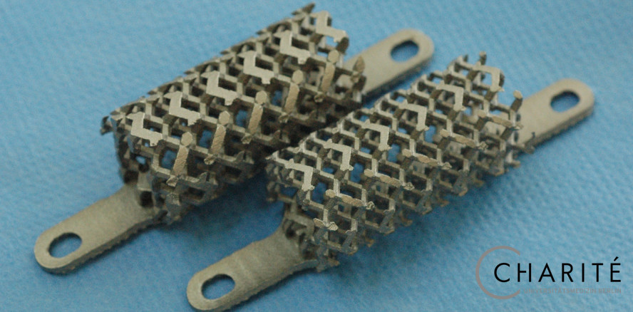 Wie Metallstrukturen effektiv helfen, Knochen zu heilen