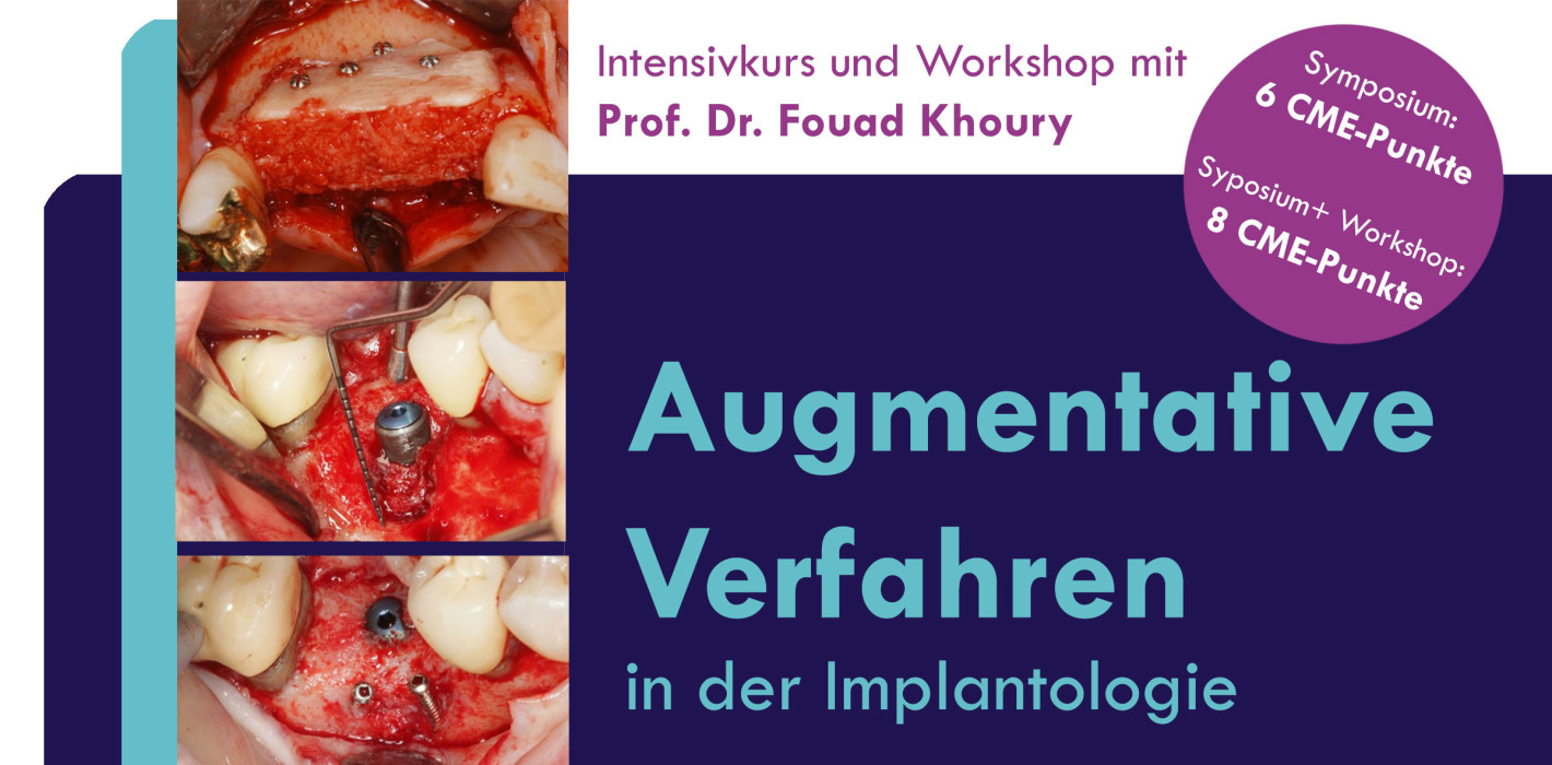 Intensivkurs „Augmentative Ver­fahren in der Implantologie“