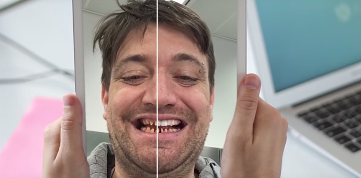 Virtuelle Anprobe: Schönere Zähne dank Augmented Reality