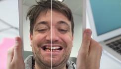 Virtuelle Anprobe: Schönere Zähne dank Augmented Reality