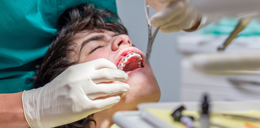 Unsachgemäße KFO-Behandlung verschlimmert Zahnfehlstellungen