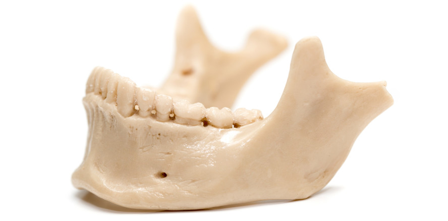 Kieferknochen aus dem Drucker: Forschungserfolg beim Bioprinting