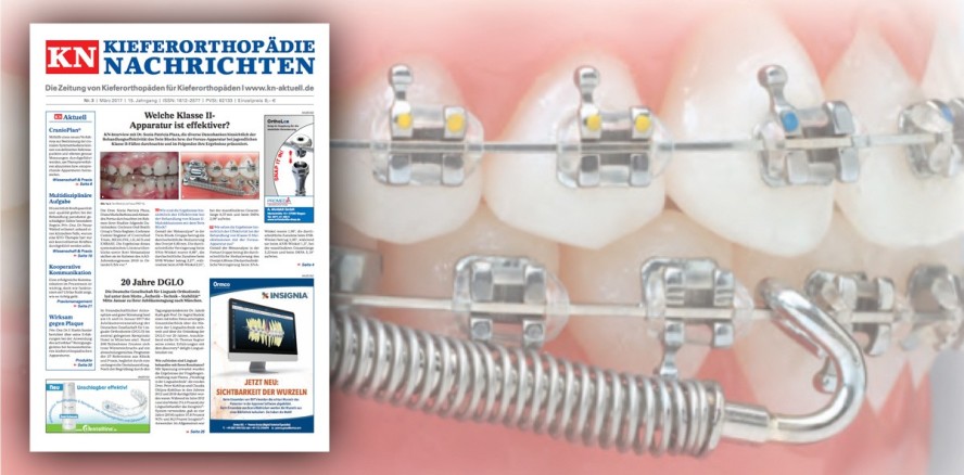 Aktuelle KN widmet sich der Effektivität von Klasse II-Apparaturen