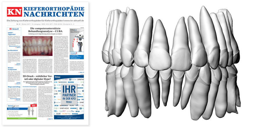 Die KN im Oktober: Computerunterstützte Behandlungsanalyse