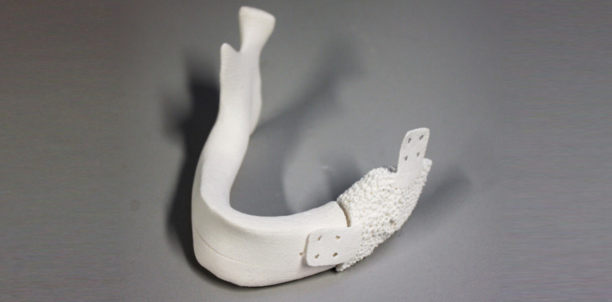 Hybridmaterial soll Knochen zum Wachsen anregen