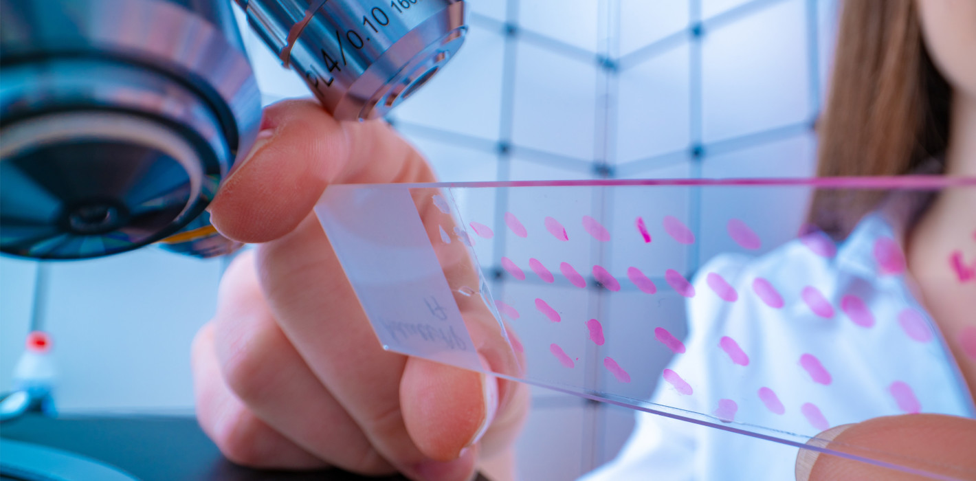 Krebs: Biopsie bald durch Speicheltest abgelöst?