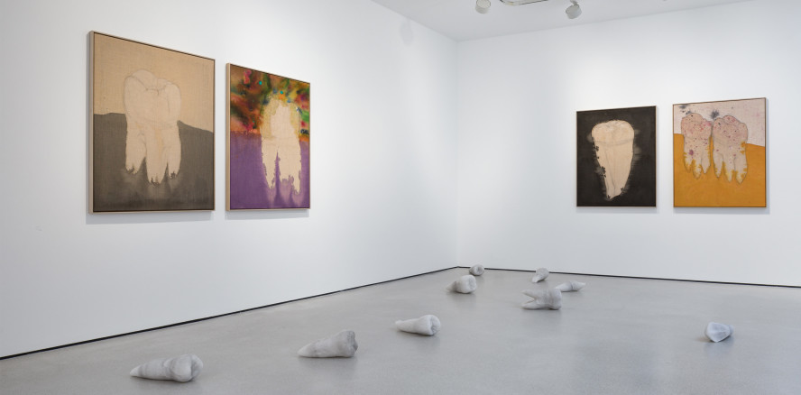 Thema Zähne: Künstler Michael Sailstorfer eröffnet Ausstellung