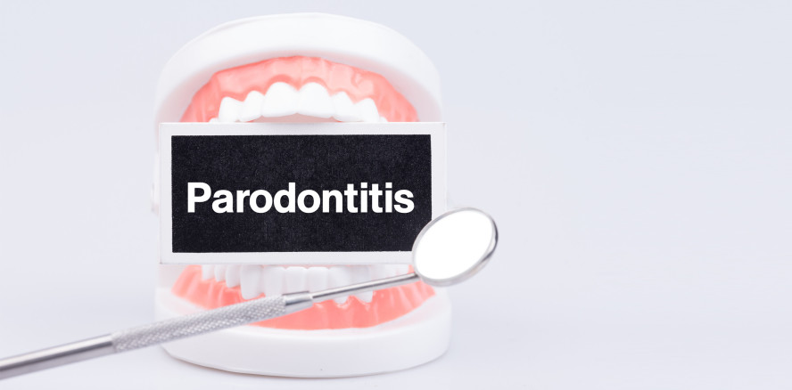 #gumhealthday: Europäischer Tag der Parodontologie