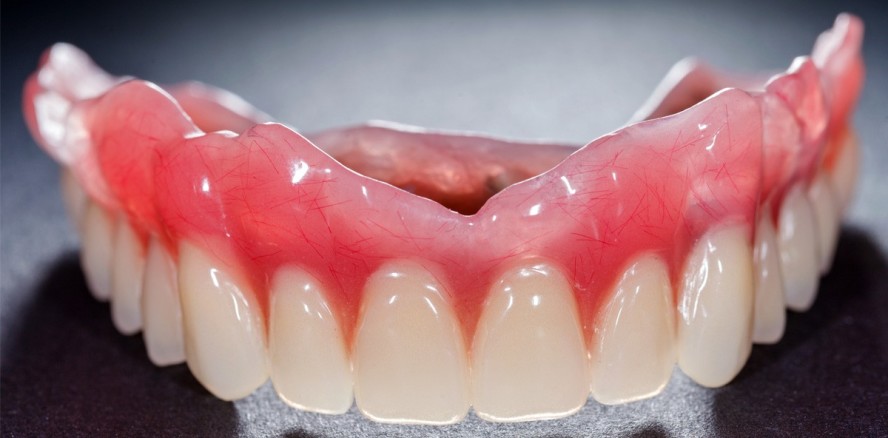 Update: S3-Leitlinie zur Versorgung des zahnlosen Oberkiefers