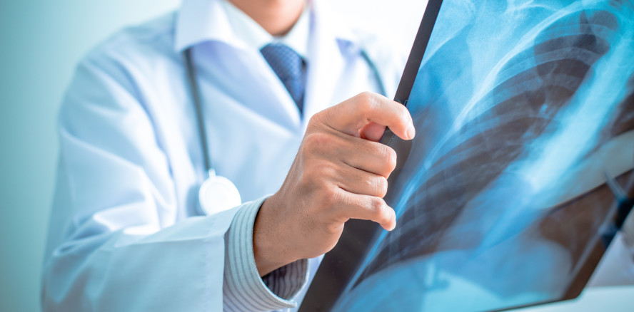 Zahnärzte & Personal: Risikogruppe für tödliche Lungenkrankheit?