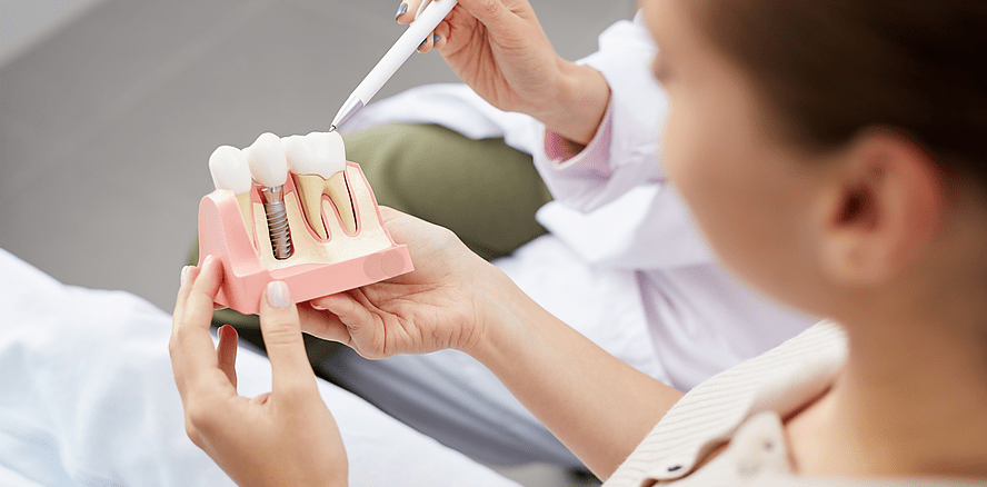 Besser, haltbarer, sicherer: MHH entwickelt maßgeschneiderte Zahnimplantate