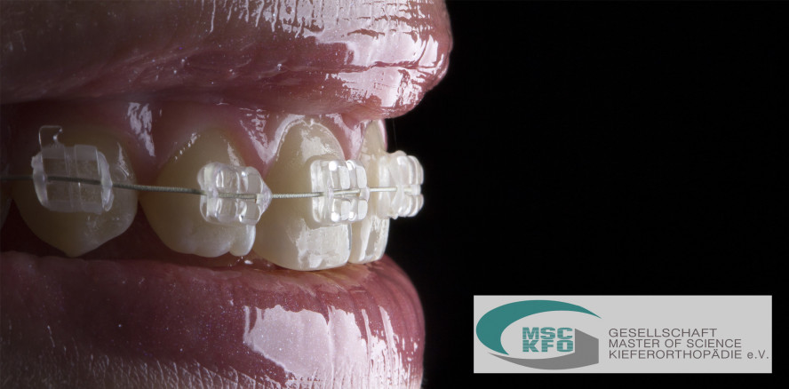 Master of Science Kieferorthopädie geht in die nächste Runde