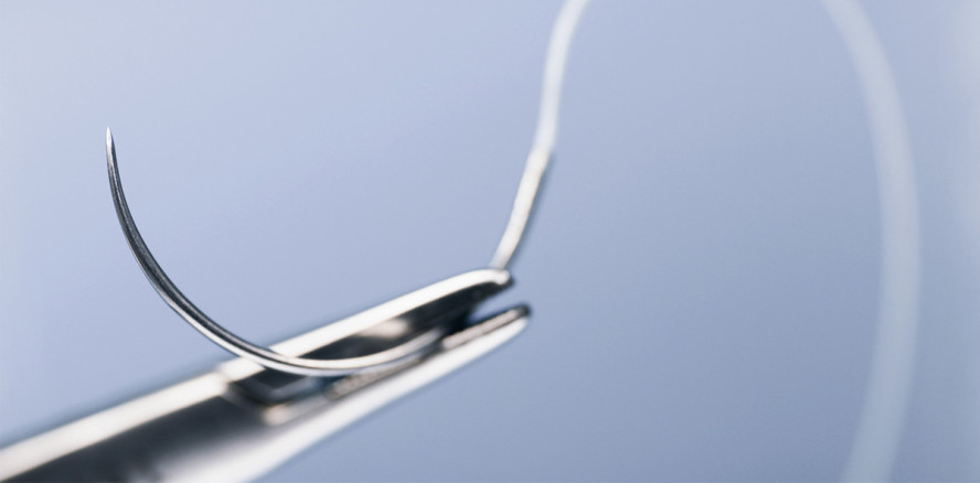 Wundverschluss ist Vertrauenssache