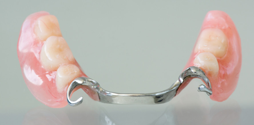 Metalle im Mund: Krebsfördernd wie Rauchen und Alkohol?