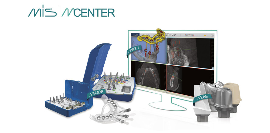 MCENTER und MGUIDE: Rundum-Lösung für digital navigierte Implantation
