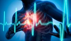„Time is Muscle“: Herzinfarkt im Praxisalltag
