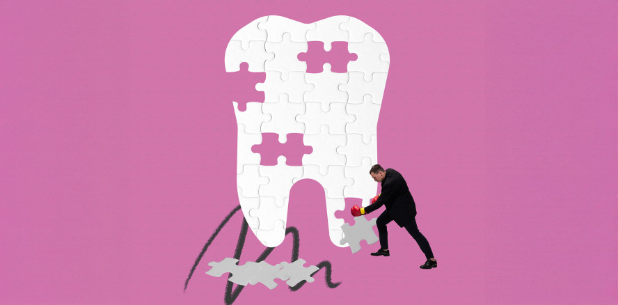 Nach dem Aus für Amalgam: Alternativen ohne zusätzliche Kosten