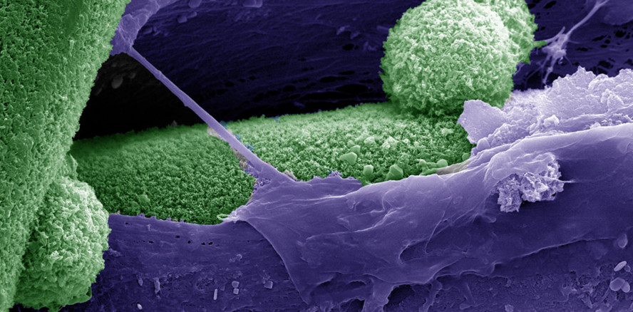 Hauptschalter für die Regeneration von Knochengewebe identifiziert