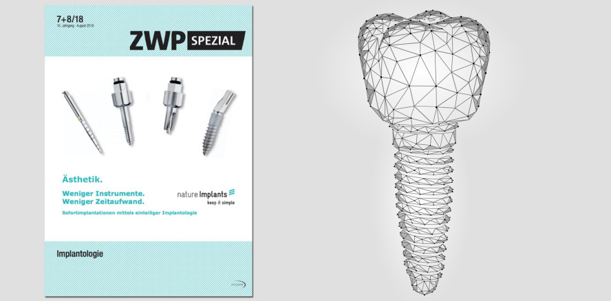 Schwerpunktthema „Implantologie“: Aktuelles ZWP spezial jetzt online