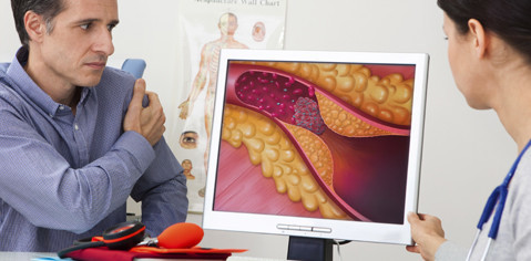 Orale Bakterien: Welche Rolle spielen sie beim Schlaganfall?