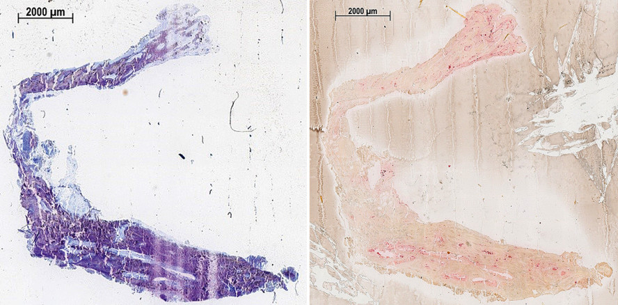 Osseointegration von Zirkoniumdioxid- und Titanimplantaten