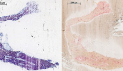 Osseointegration von Zirkoniumdioxid- und Titanimplantaten